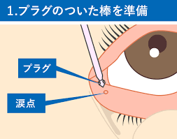 図：涙点プラグ