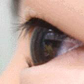 写真:逆まつげ