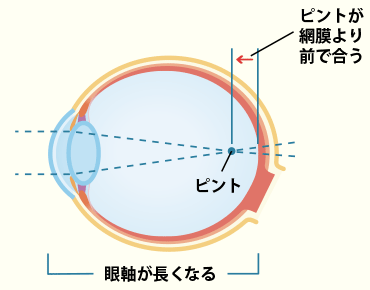 図：ピントが合う位置