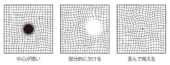 写真: